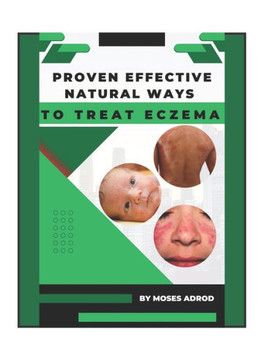 Proven Effective Natural Ways to Treat Eczema