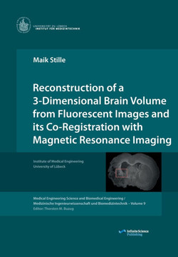 Reconstruction of a 3-Dimensional Brain Volume from Fluorescent Images and its Co-Registration with Magnetic Resonance Imaging