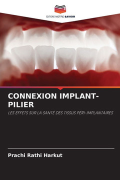Connexion Implant-Pilier