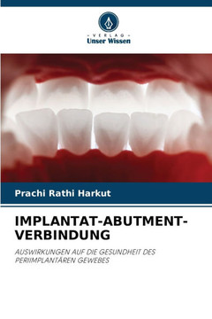 Implantat-Abutment-Verbindung Implantat-Abutment-Verbindung