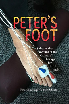 Peter'S Foot : Calmare Treatment For Rsd Pain Relief