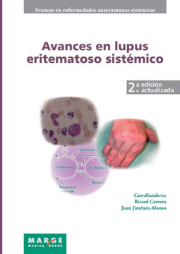 Avances en lupus eritematoso sistémico Avances en lupus eritematoso sistémico