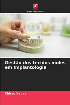 Gestão dos tecidos moles em Implantologia