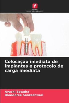 Colocação imediata de implantes e protocolo de carga imediata