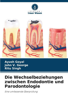 Die Wechselbeziehungen zwischen Endodontie und Parodontologie