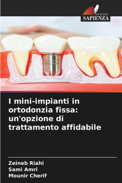 I mini-impianti in ortodonzia fissa: un'opzione di trattamento affidabile