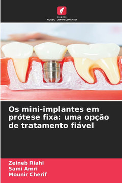 Os mini-implantes em prótese fixa: uma opção de tratamento fiável