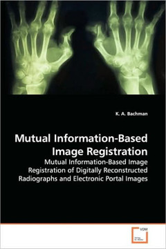 Mutual Information-Based Image Registration