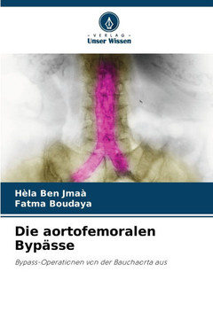 Die aortofemoralen Byp?se