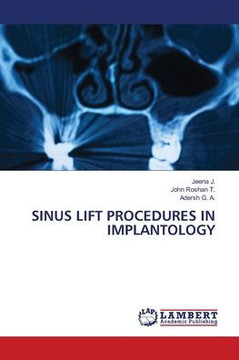 Sinus Lift Procedures in Implantology Sinus Lift Procedures in Implantology