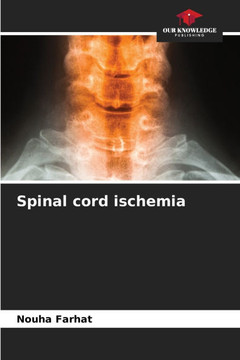 Spinal cord ischemia