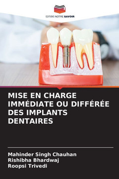 Mise En Charge Imm?iate Ou Diff?? Des Implants Dentaires