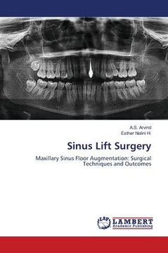 Sinus Lift Surgery Sinus Lift Surgery