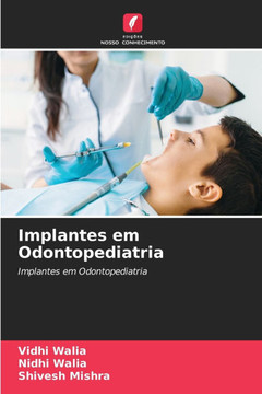 Implantes em Odontopediatria Implantes em Odontopediatria