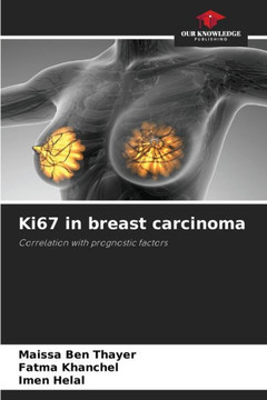 Ki67 in breast carcinoma