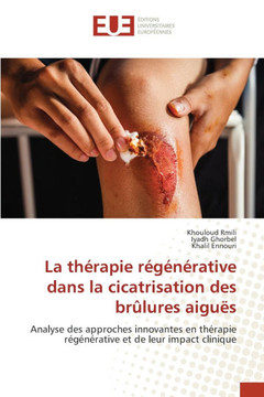 La th?apie r???ative dans la cicatrisation des br?ures aigu?