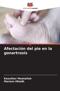 Afectaci? del pie en la gonartrosis