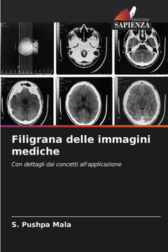 Filigrana delle immagini mediche