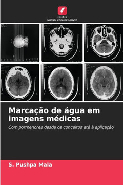 Marcação de água em imagens médicas
