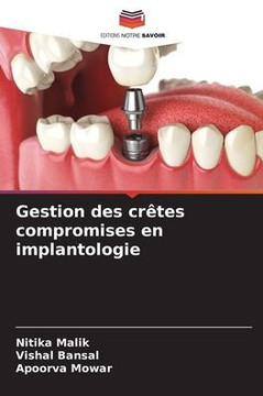 Gestion des crêtes compromises en implantologie