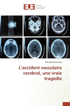 L'Accident Vasculaire Cerebral, Une Vraie Trag?ie