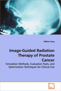 Image-Guided Radiation Therapy of Prostate Cancer