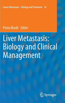 Liver Metastasis: Biology and Clinical Management