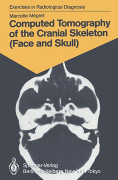 Computed Tomography of the Cranial Skeleton (Face and Skull): 58 Radiological Exercises for Students and Practitioners