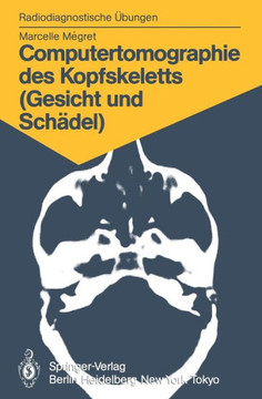 Computertomographie Des Kopfskeletts (Gesicht Und Sch?del): 58 Diagnostische ?bungen F?r Studenten Und Praktische Radiologen