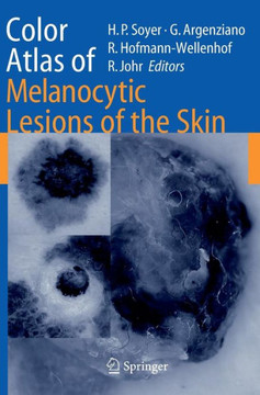Color Atlas of Melanocytic Lesions of the Skin