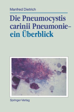 Die Pneumocystis Carinii Pneumonie-- Ein ?berblick