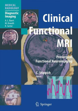 Clinical Functional MRI: Presurgical Functional Neuroimaging