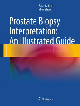 Prostate Biopsy Interpretation: An Illustrated Guide Prostate Biopsy Interpretation: An Illustrated Guide