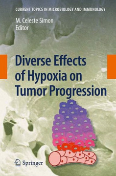 Diverse Effects of Hypoxia on Tumor Progression