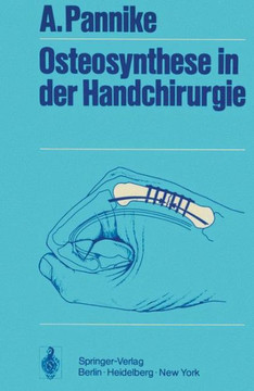 Osteosynthese in Der Handchirurgie