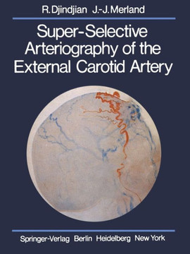 Super-Selective Arteriography of the External Carotid Artery