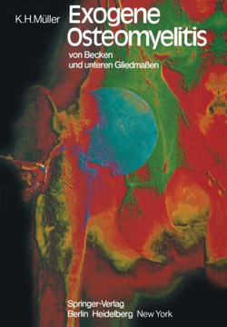 Exogene Osteomyelitis Von Becken Und Unteren Gliedma?en: Besonderheiten Pathogenese Klinik Therapie Ergebnisse