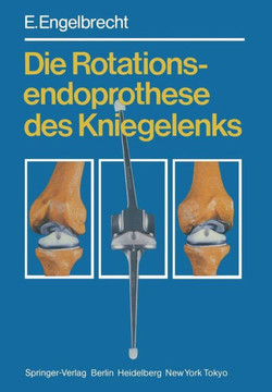 Die Rotationsendoprothese Des Kniegelenks