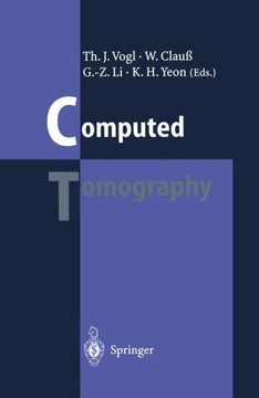Computed Tomography: State of the Art and Future Applications