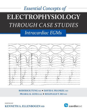 Essential Concepts of Electrophysiology Through Case Studies: Intracardiac EGMs: Intracardiac EGMs