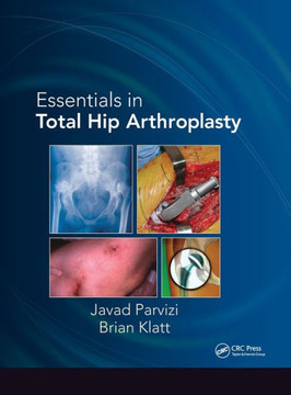 Essentials in Total Hip Arthroplasty Essentials in Total Hip Arthroplasty