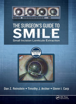 The Surgeon's Guide to SMILE: Small Incision Lenticule Extraction