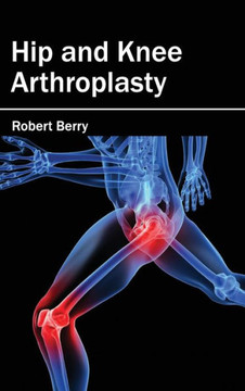 Hip and Knee Arthroplasty Hip and Knee Arthroplasty