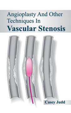 Angioplasty and Other Techniques in Vascular Stenosis Angioplasty and Other Techniques in Vascular Stenosis