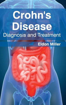 Crohn's Disease: Diagnosis and Treatment