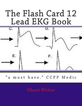 The Flash Card 12 Lead EKG The Flash Card 12 Lead EKG