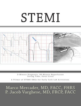 Stemi: 3-Minute Diagnosis, 90-Minute Reperfusion: Saving Time, Saves Lives