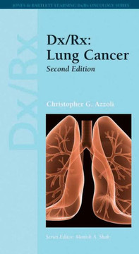 DX/Rx: Lung Cancer: Lung Cancer DX/Rx: Lung Cancer: Lung Cancer