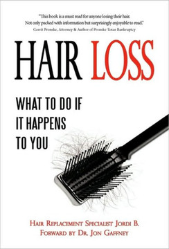 Hair Loss: What to do if it Happens to You - 9781450203500