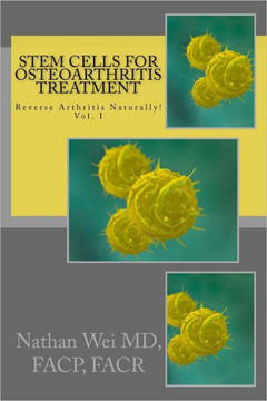Stem Cells for Osteoarthritis Treatment: An easy to understand ""consumer's guide"" to understanding how stem cells are used to treat osteoarthritis.